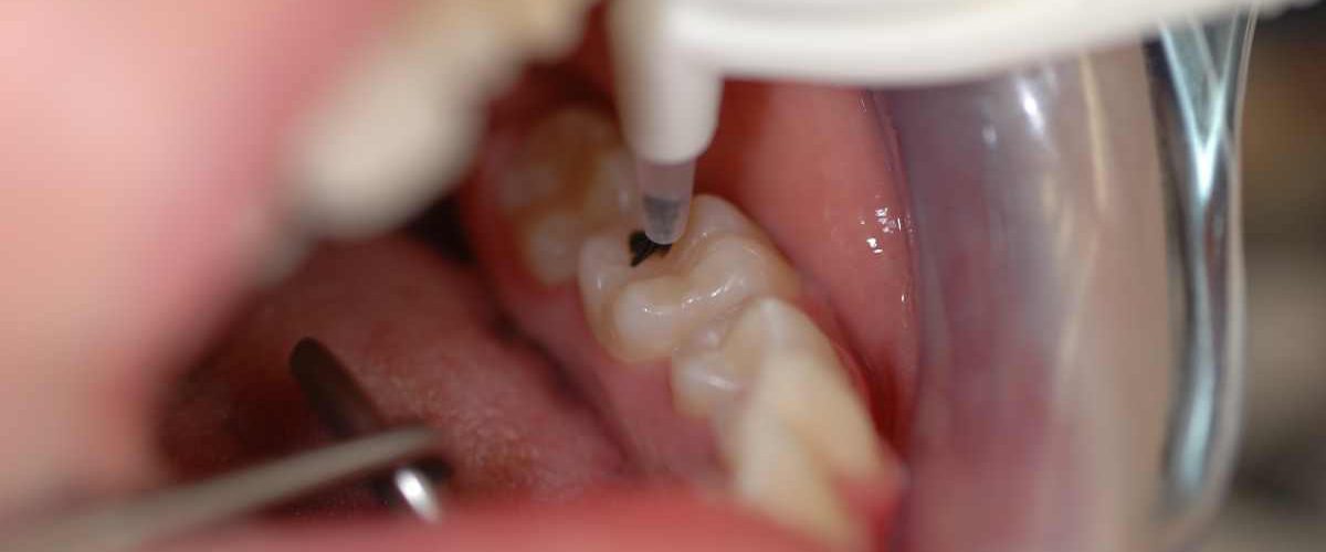 CRT-Ergebnisse-Dr.-Laurisch-8-o4cnnmr9rh8tbd7razb5dczsf0f76rxv8rxsa7p0ug